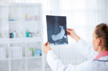 Cancer pancreatic – noi tratamente testate cu ajutorul organoizilor