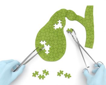 Litiaza biliară: metode de diagnostic, tratament și complicații