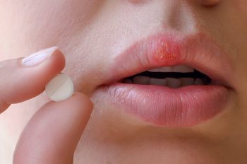 Afecțiunile mucoasei bucale – diagnostic şi tratament