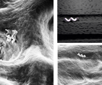 Nanoboţii care generează căldură, viitorul tratamentelor dentare
