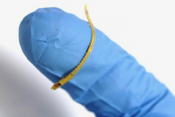 Un stent arterial inteligent poate furniza informaţii despre fluxul sangvin