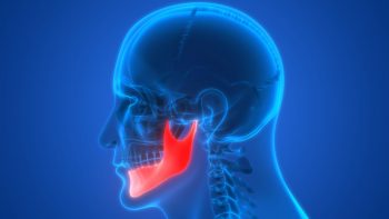 Fracturi de mandibulă, diagnostic și tratament
