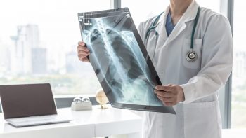 Prescrierea exerciţiului fizic pacienţilor cu BPOC