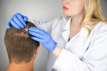Alopecia non-cicatriceală: caracteristici, diagnostic, tratament