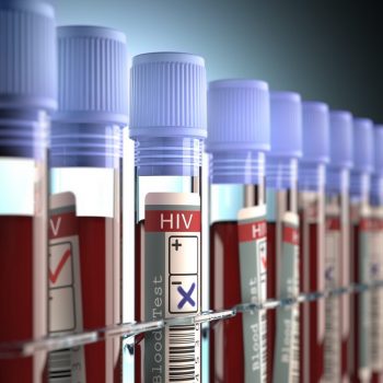 Al patrulea pacient din lume vindecat de HIV