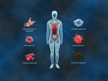 Primul transplant de organoid la un pacient care are colită ulcerativă