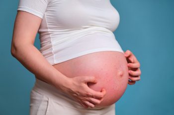 Dermatozele asociate în mod specific cu sarcina