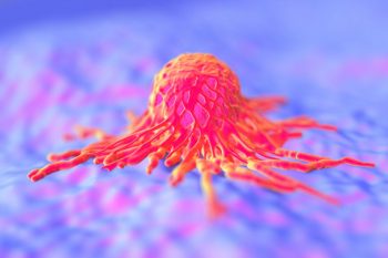 Implant asemănător unui gel, eficient în tratarea cancerului pancreatic