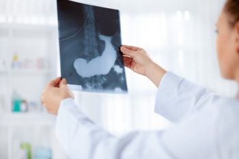 Pancreas artificial pentru pacienții cu diabet tip 2
