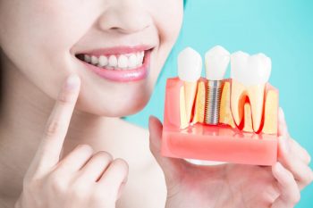 Simptome și riscuri asociate respingerii implantului dentar