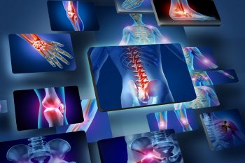 Terapia durerii cronice