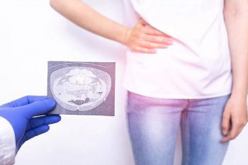 Apendicita: cauze, simptome, diagnostic și tratament