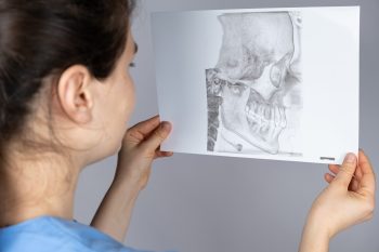 Ameloblastomul – de la diagnostic, la tratament