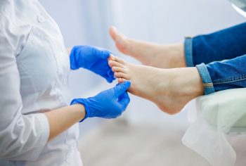 Micozele cutanate: infecții fungice comune în sezonul cald și tratamente eficiente