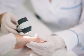 Informații despre urticaria de căldură (miliaria)