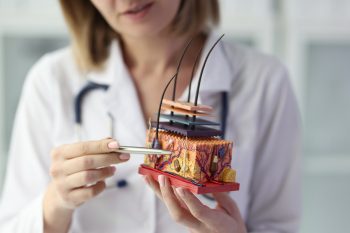 Xeroderma pigmentosum (XP), o genodermatoză rară cu fotosensibilitate extremă