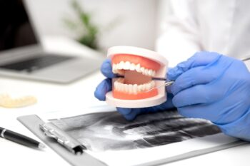Proteza dentară scheletată versus alte opțiuni de înlocuire a dinților. Avantaje și dezavantaje?