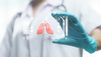 Prof. Dr. Mir Alireza Hoda: „Imunoterapia a revoluționat tratamentul cancerului pulmonar”