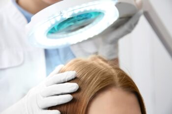 Căderea părului la femei: cauze și opțiuni de tratament