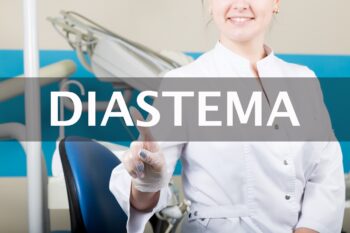 Diastema dentară (strungăreața) – cauze, impact și opțiuni de tratament