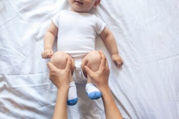 Displazia de șold la nou-născuți – cauze, simptome și diagnostic