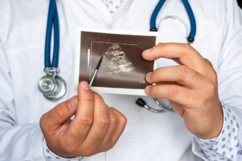 Chisturi la rinichi – diagnostic și gestionare