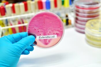 Infecția cu Escherichia coli – simptome, diagnostic și management