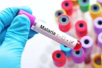Malaria, între riscuri actuale și strategii profilactice