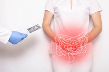 Pouchita – clasificare, diagnostic și opțiuni terapeutice