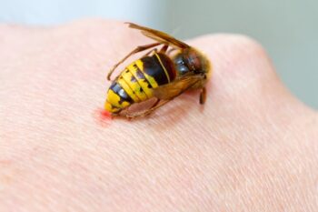 Managementul reacțiilor alergice severe la înțepături de insecte