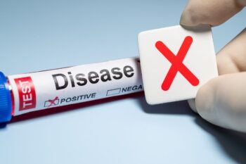 Boala X: identificare precoce, diagnostic diferențial și provocări clinice