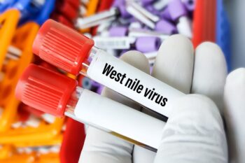 Febra West Nile: cauze, simptome, diagnostic și management