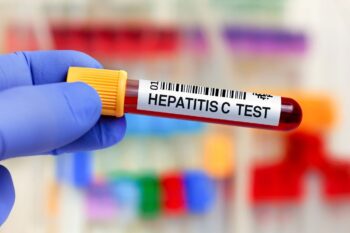 Noi algoritmi de diagnostic și tratament în hepatita C cronică