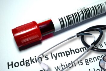 Boala Hodgkin (limfom Hodgkin): cauze, simptome, diagnostic precoce și management