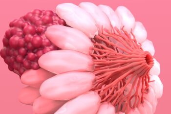 Nou biomarker al cancerului de sân, descoperit cu ajutorul AI