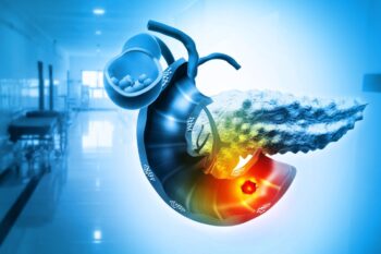 Neoplasm pancreatic: manifestări clinice și tratament