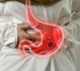 ulcer gastric