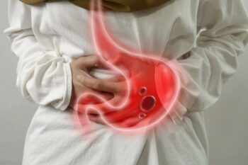 Ulcer gastric: patogenie, diagnostic și management terapeutic
