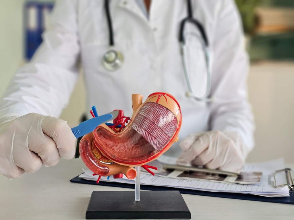 ulcer gastric perforat