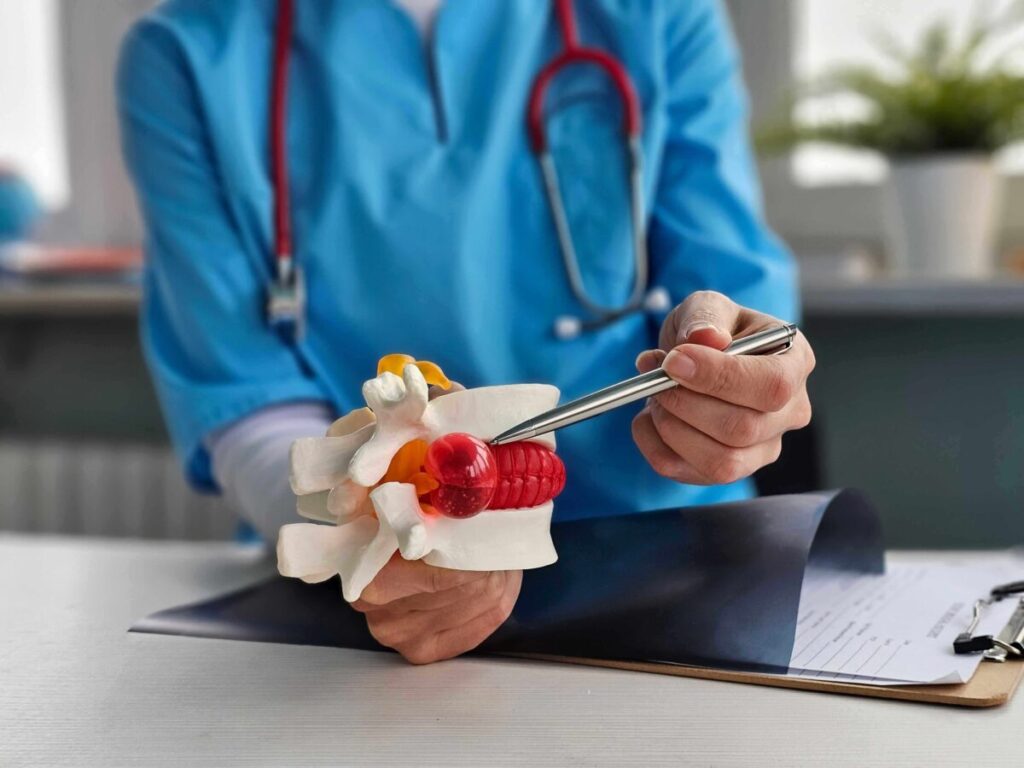 radiculopatie