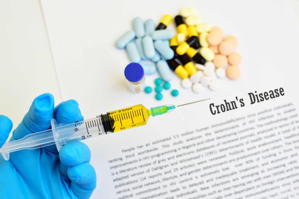 terapii crohn