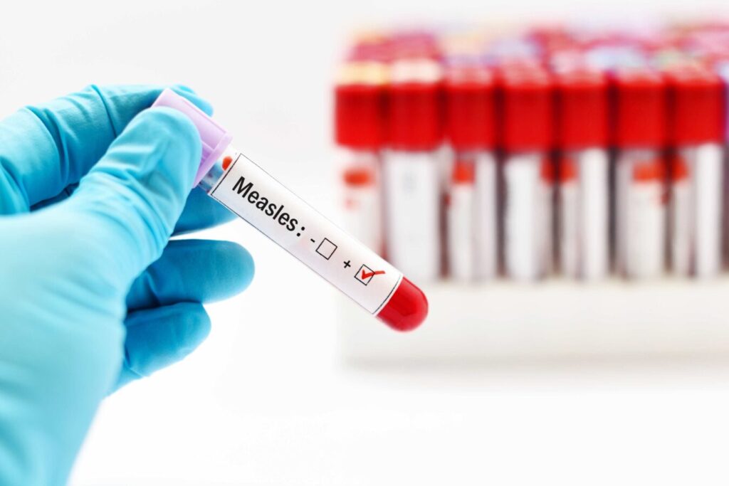 vaccin rujeola